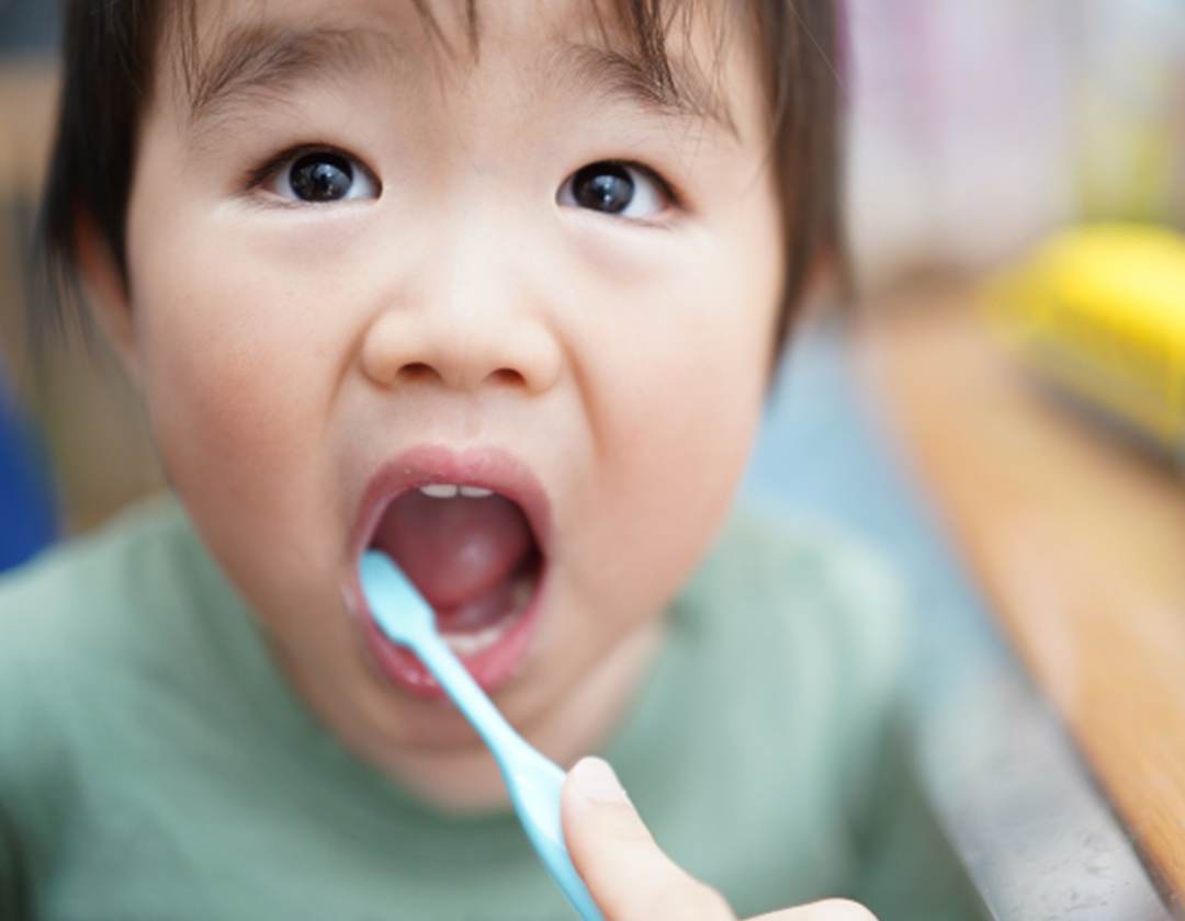 お子さまのむし歯を防ぐために