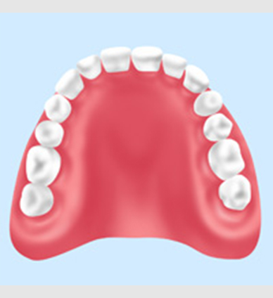 レジン床義歯(保険診療)